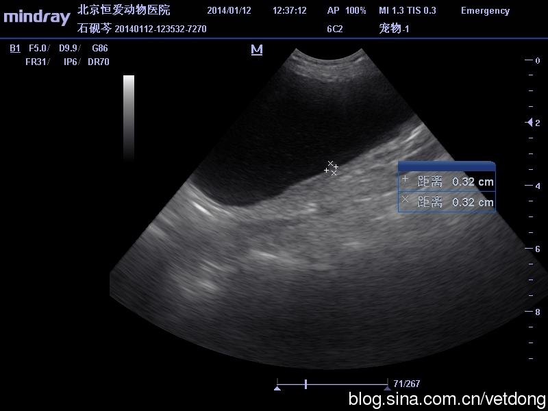 腎癌 维基百科 自由的百科全书